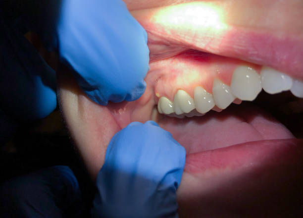 Best Emergency Cosmetic Dentistry in Hope, IN